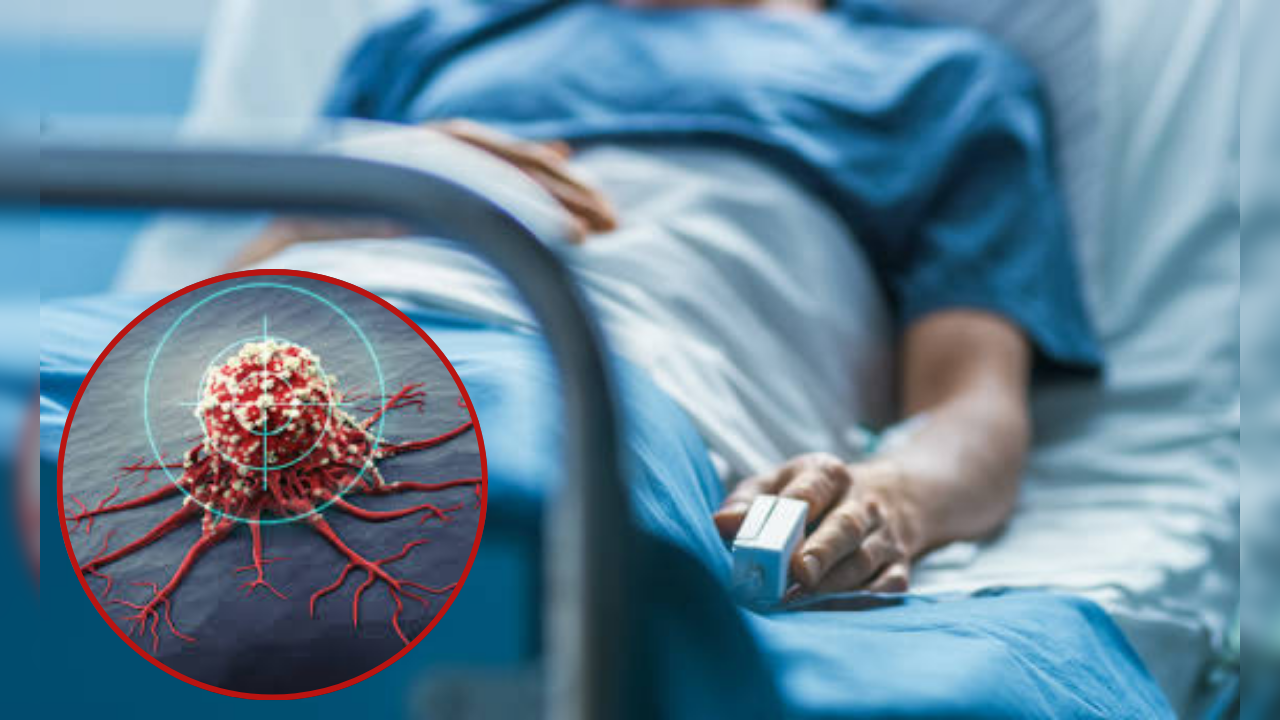 global spike on most men will die from cancer by 2050 study predicts