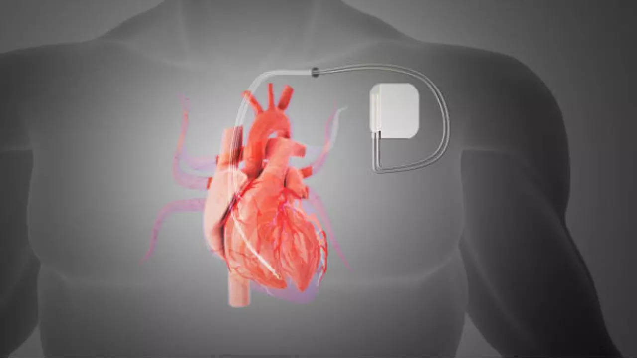 Signs that your pacemaker is failing to work