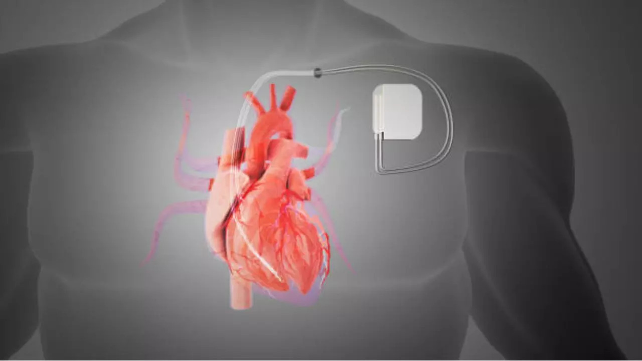 Signs that your pacemaker is failing to work