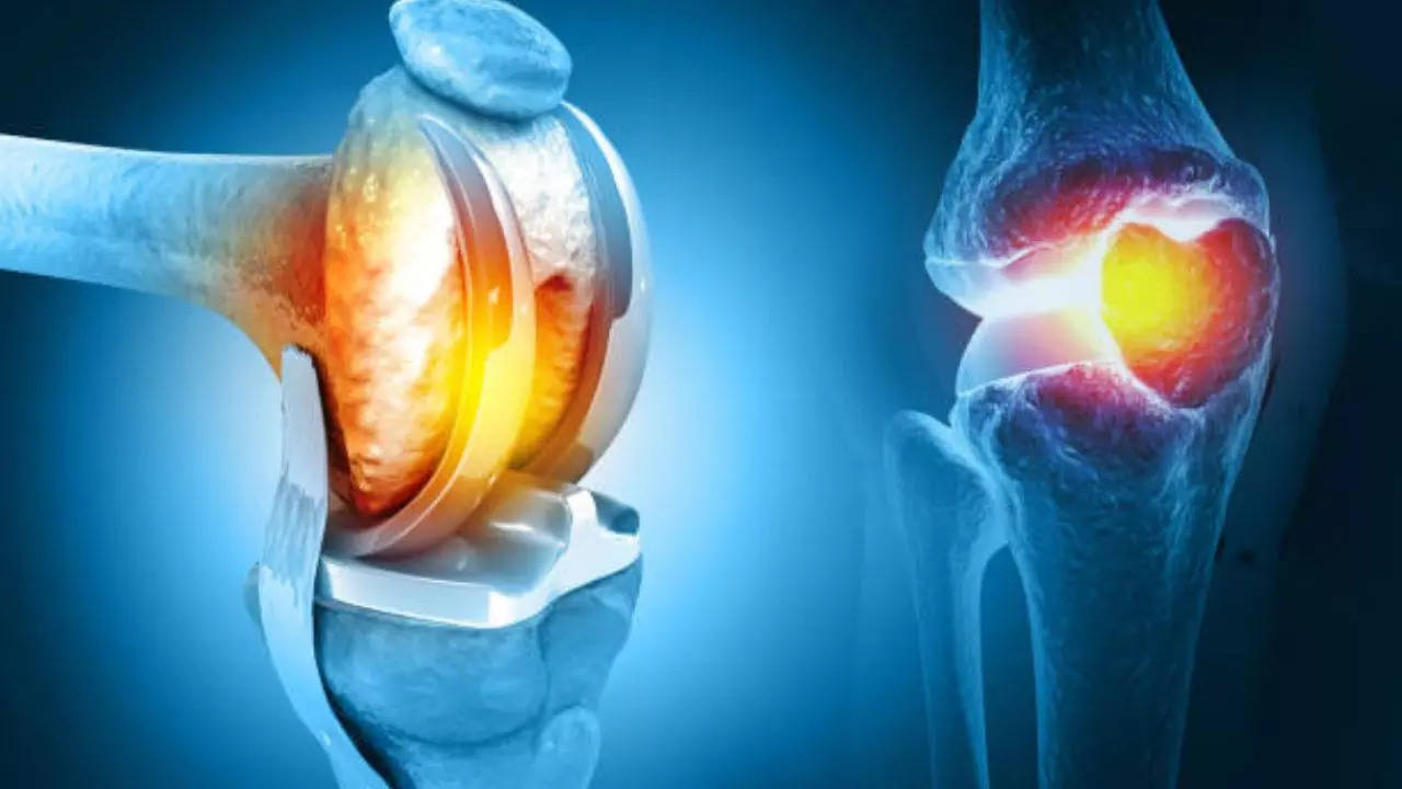 Pros and cons of traditional and robotic knee replacement surgery