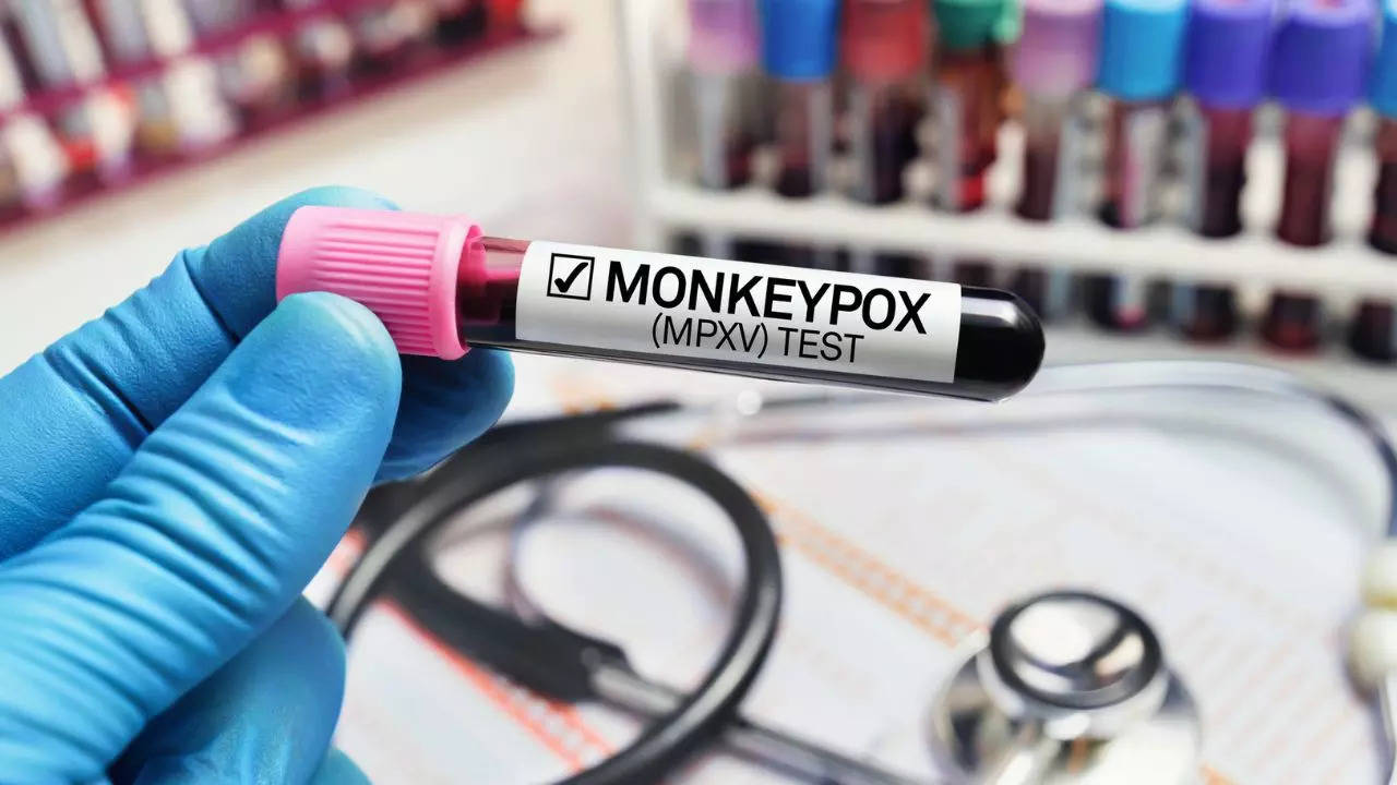 Monkeypox Virus Cases In UK: New Deadly Mpox Variant Is 'Very Likely ...