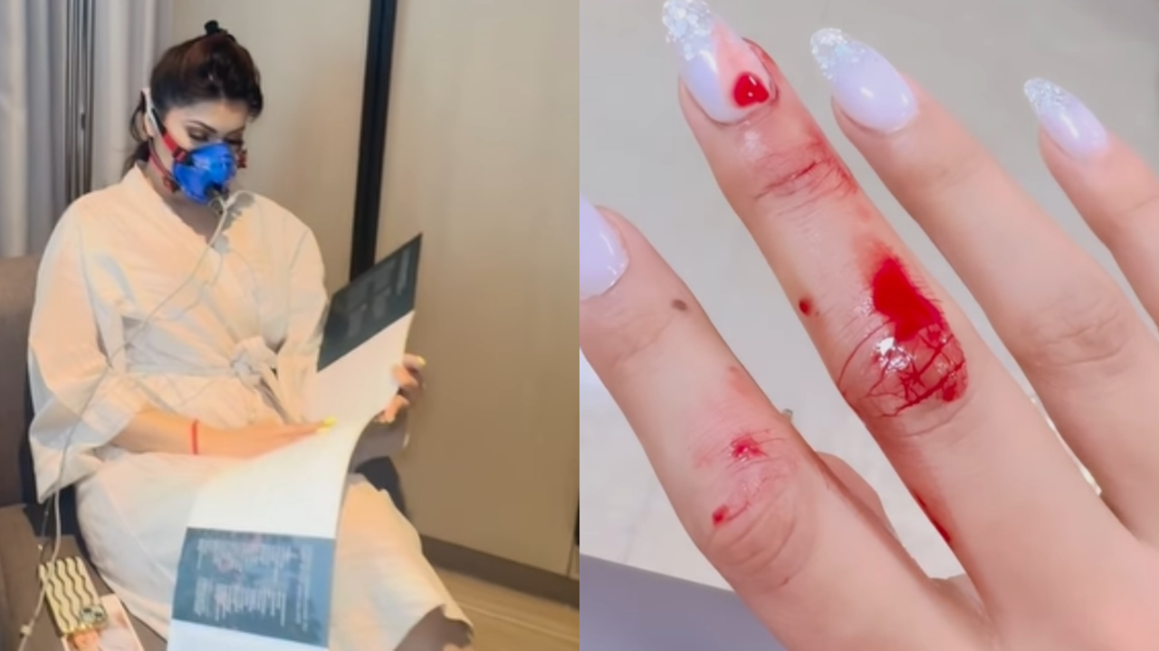 Urvashi Rautela Sustains Minor Finger Injury, Posts Video From Hospital Saying 'Pray For Me'. Fans Say Take It Easy...