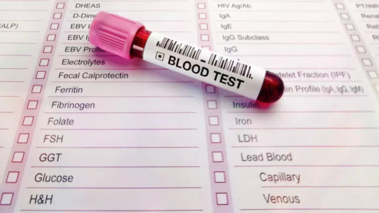 Blood Tests Could Help Predict Alzheimer's, Diabetes, and Other Age-Related Diseases: Study