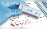 India Develops First Indigenous Mpox RT-PCR Detection Kit Gets CDSCO Approval