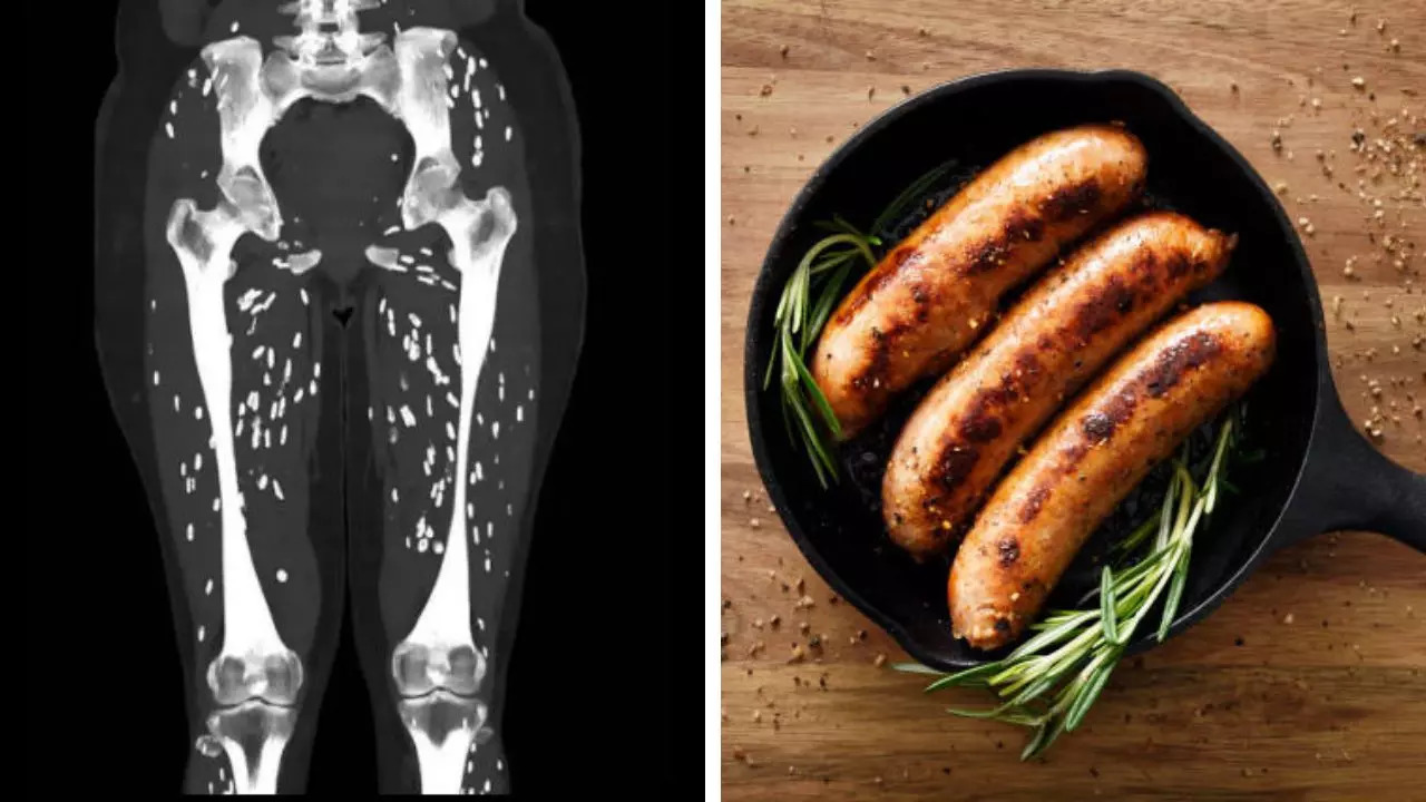 Horrific Scans Reveal The Devastating Effects of Undercooked Pork On Your Body 