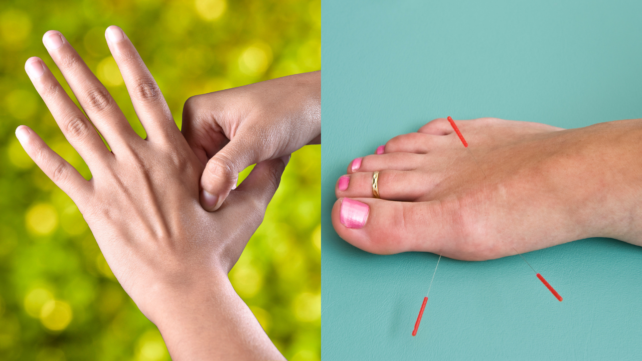 Acupressure and Acupuncture (Image - Canva)