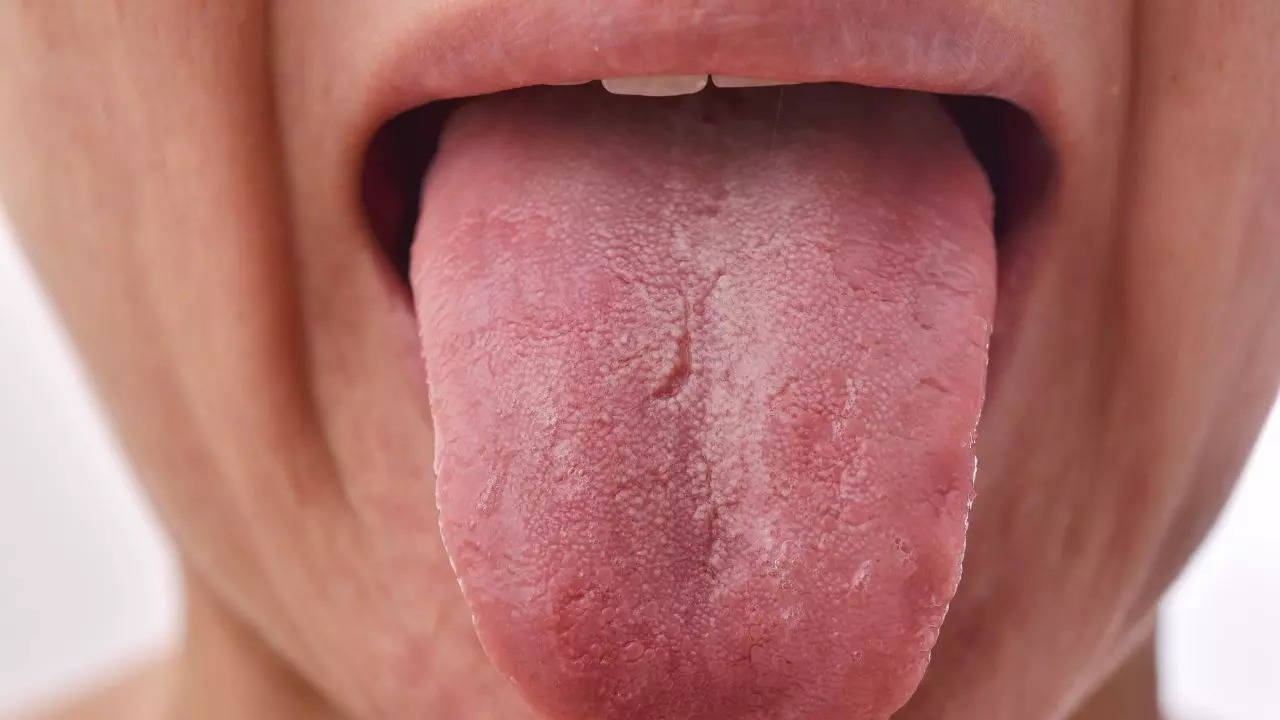 tongue color says about your health new ai machine will tell your health problem