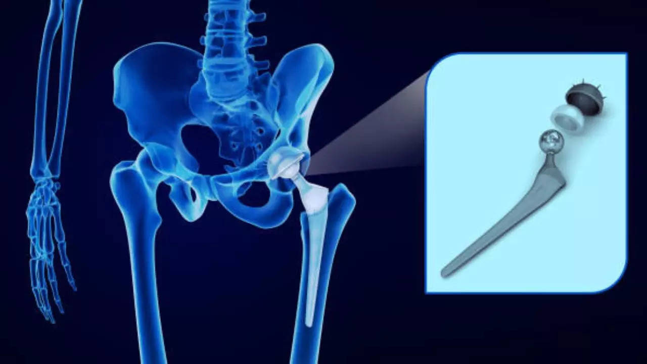 is robotic-assisted hip replacement surgery safe and effective? expert addresses common concerns