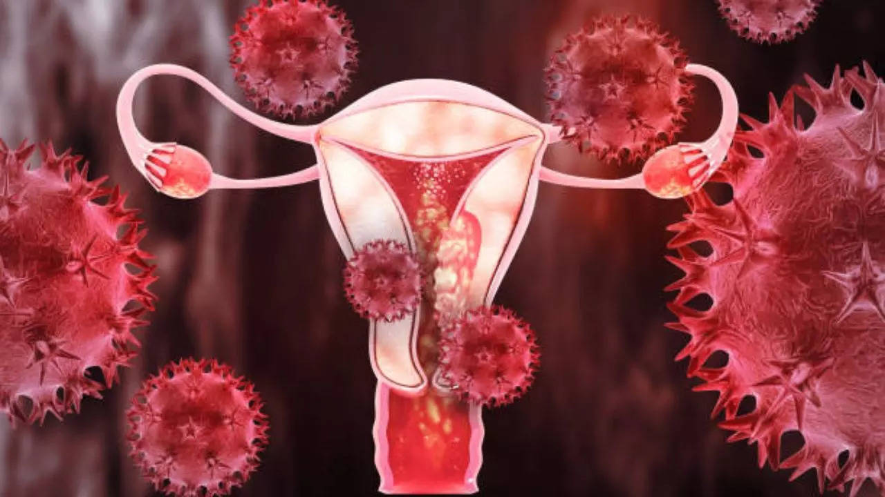 a third of women cannot identify this common symptom of endometrial cancer