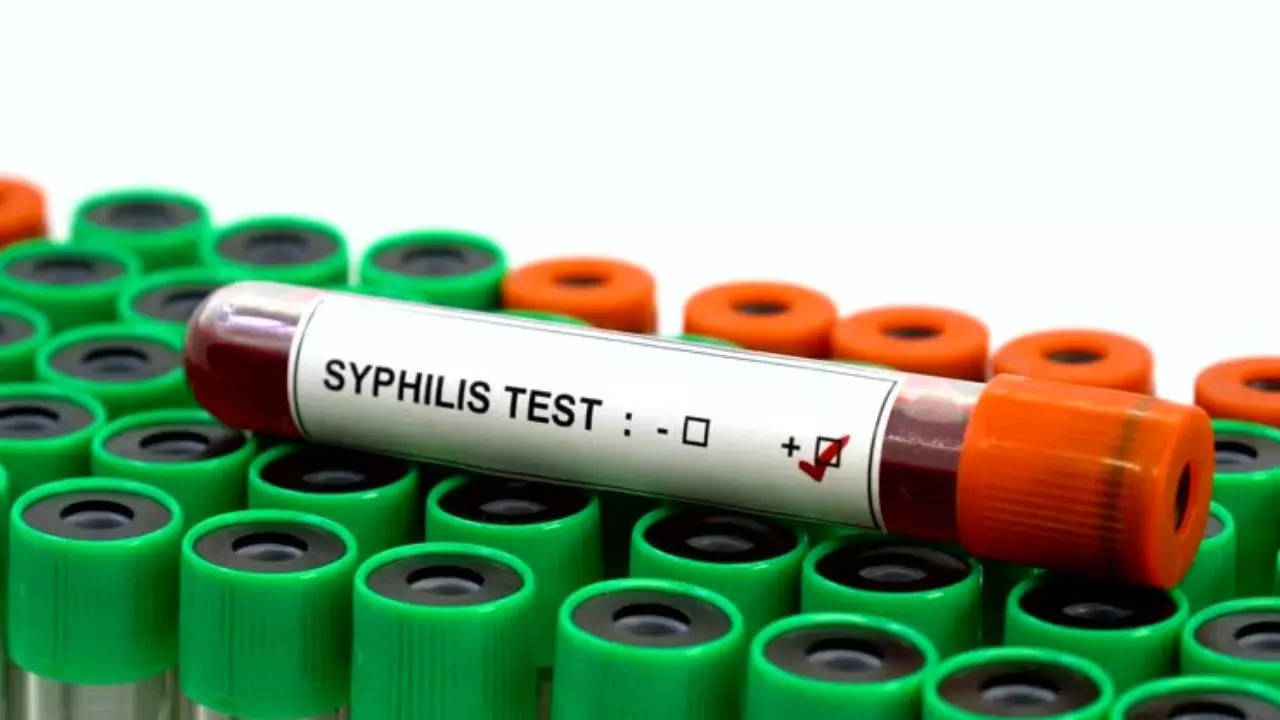 Syphilis Cases At Highest Since 1950s In US - Signs To Watch Out For