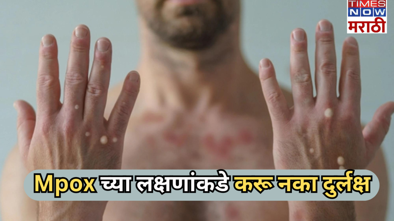 common symptoms of mpox in marathi