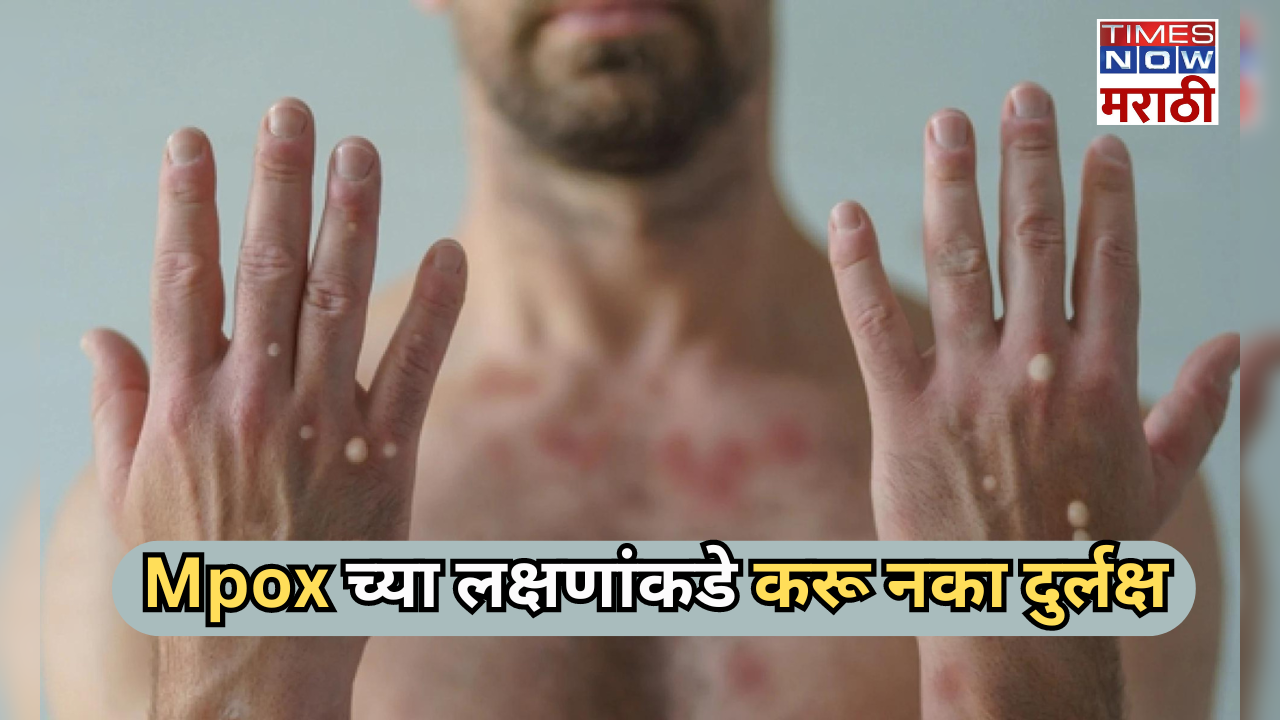 common symptoms of mpox in marathi