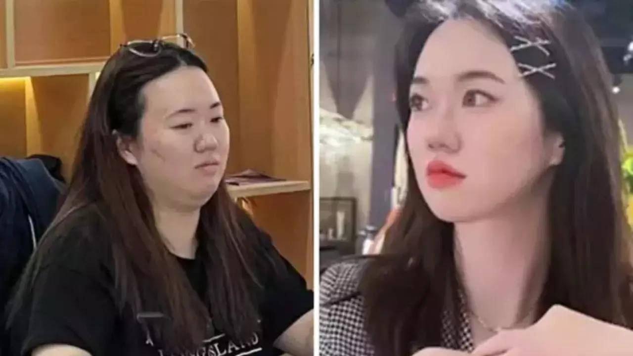 Chinese Woman Gained 20 Kilos Due To Work Stress; 6 Signs When A Professional Should Quit Their Job