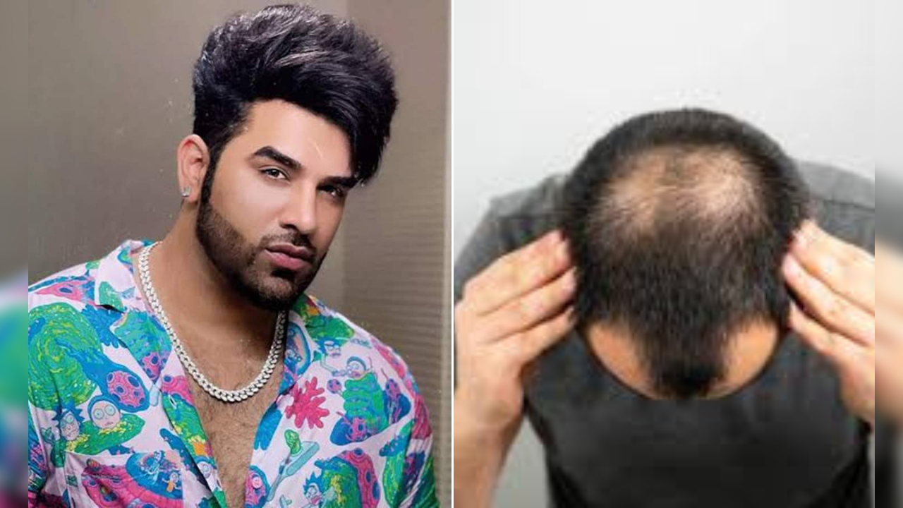 know the causes and treatment of male pattern baldness