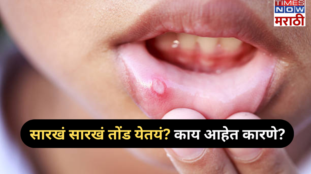 causes of  mouth  ulcer and home remedies  in marathi