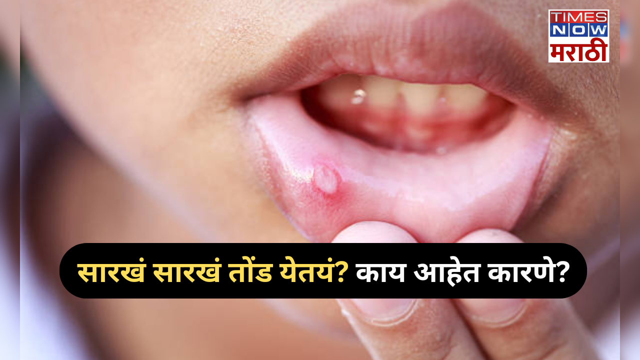 causes of  mouth  ulcer and home remedies  in marathi