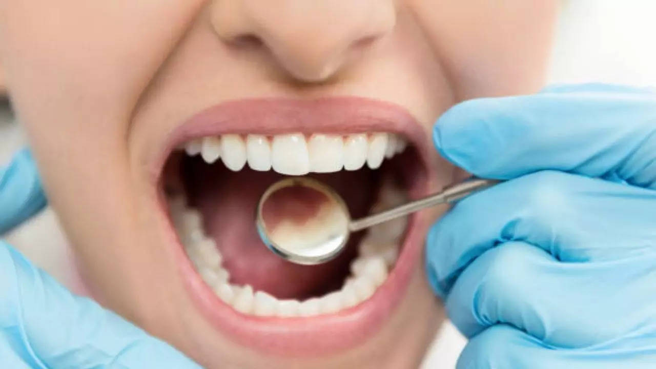 7 Common Myths Around Dental Implants Busted