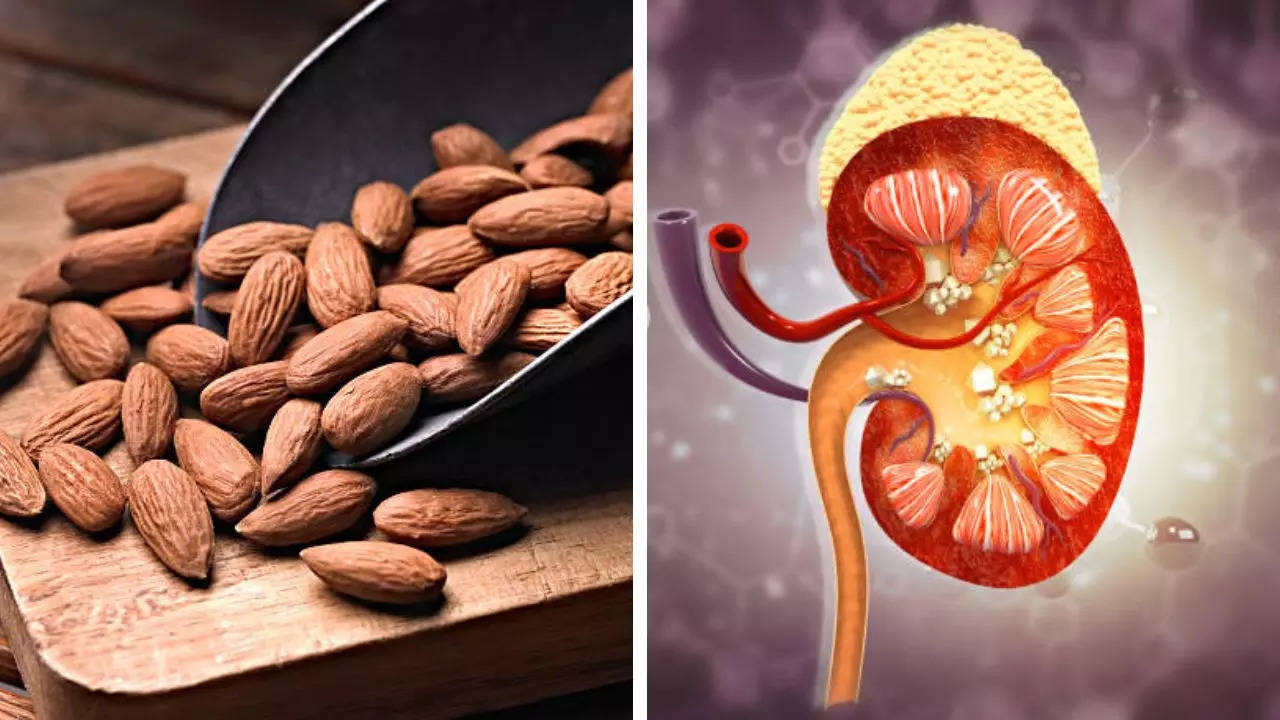 Do Almonds Cause Kidney Stones