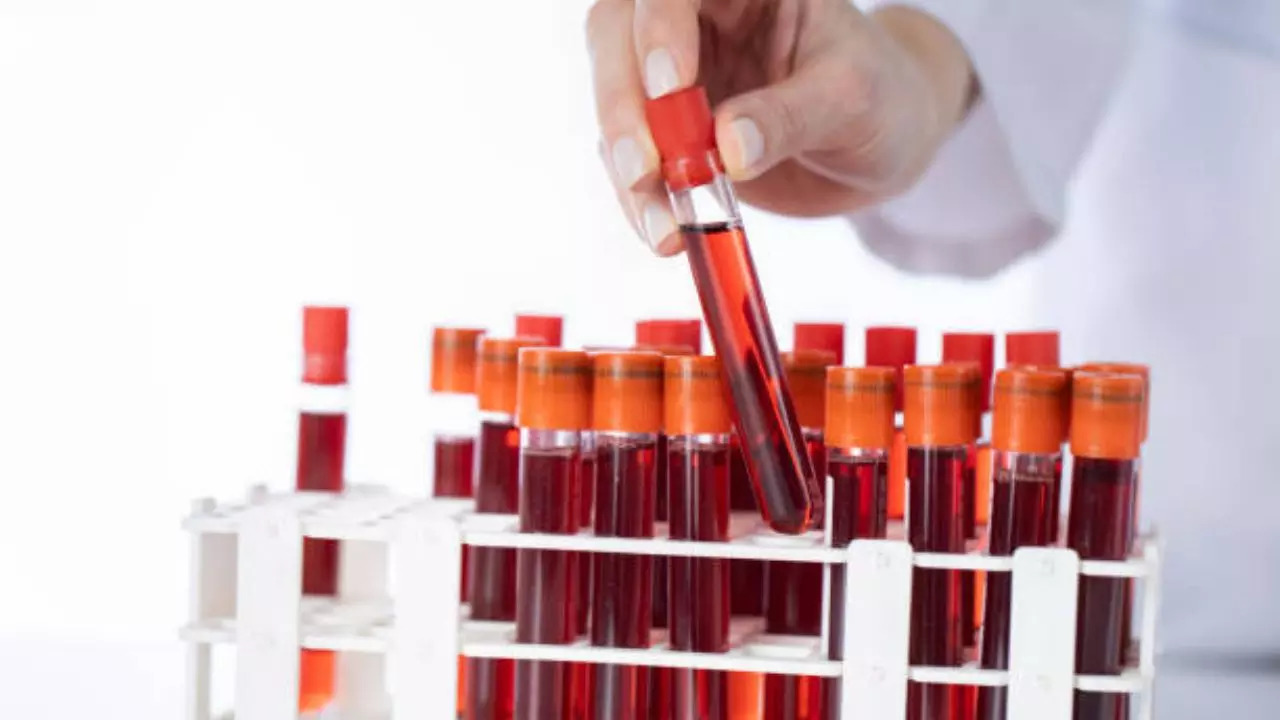 A new blood group discovered after 50 years of mystery