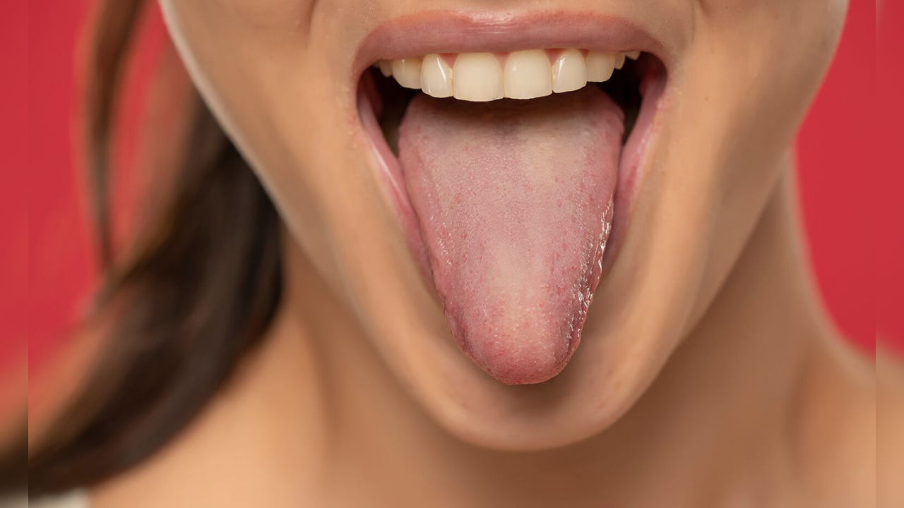 tongue color say about health in marathi