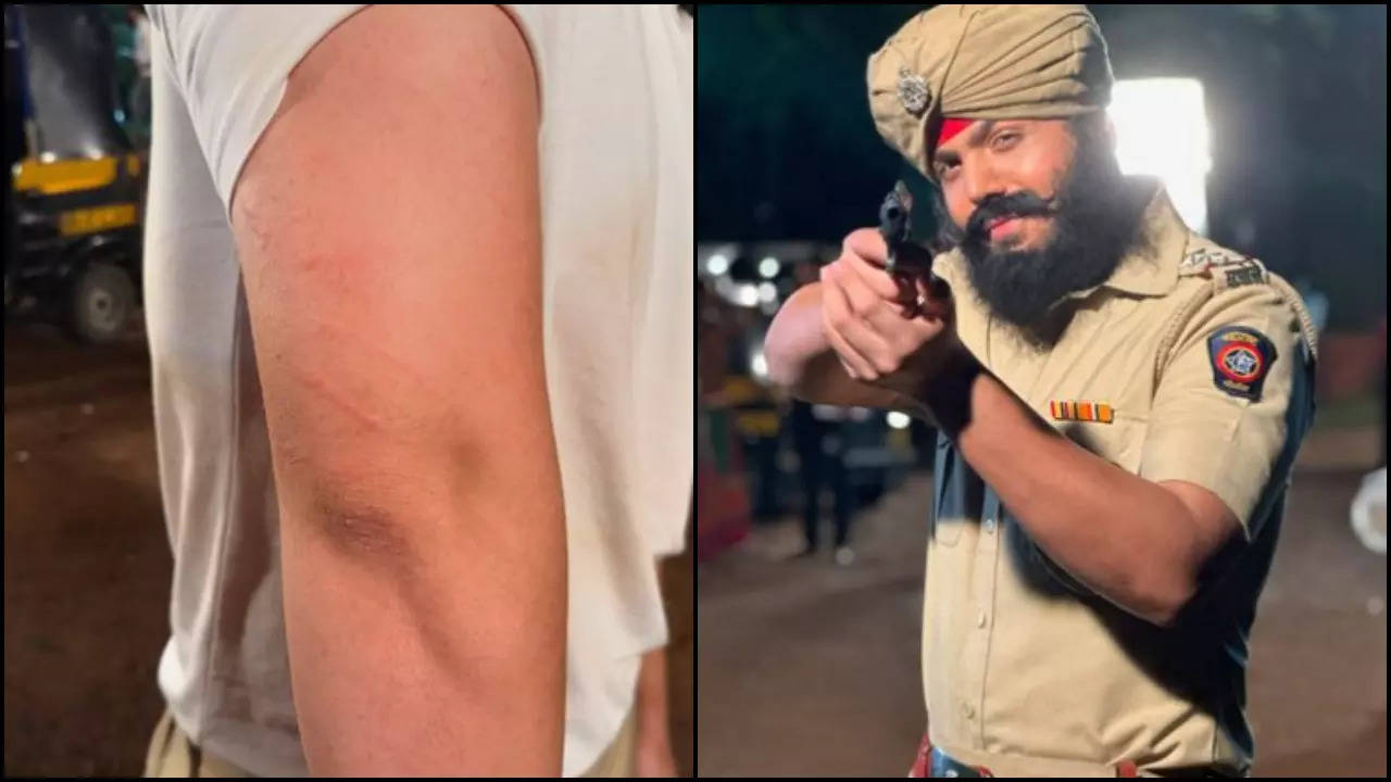 Raj Anadkat Bruises His Arms After Beating Himself With A Hunter While Filming - See Post