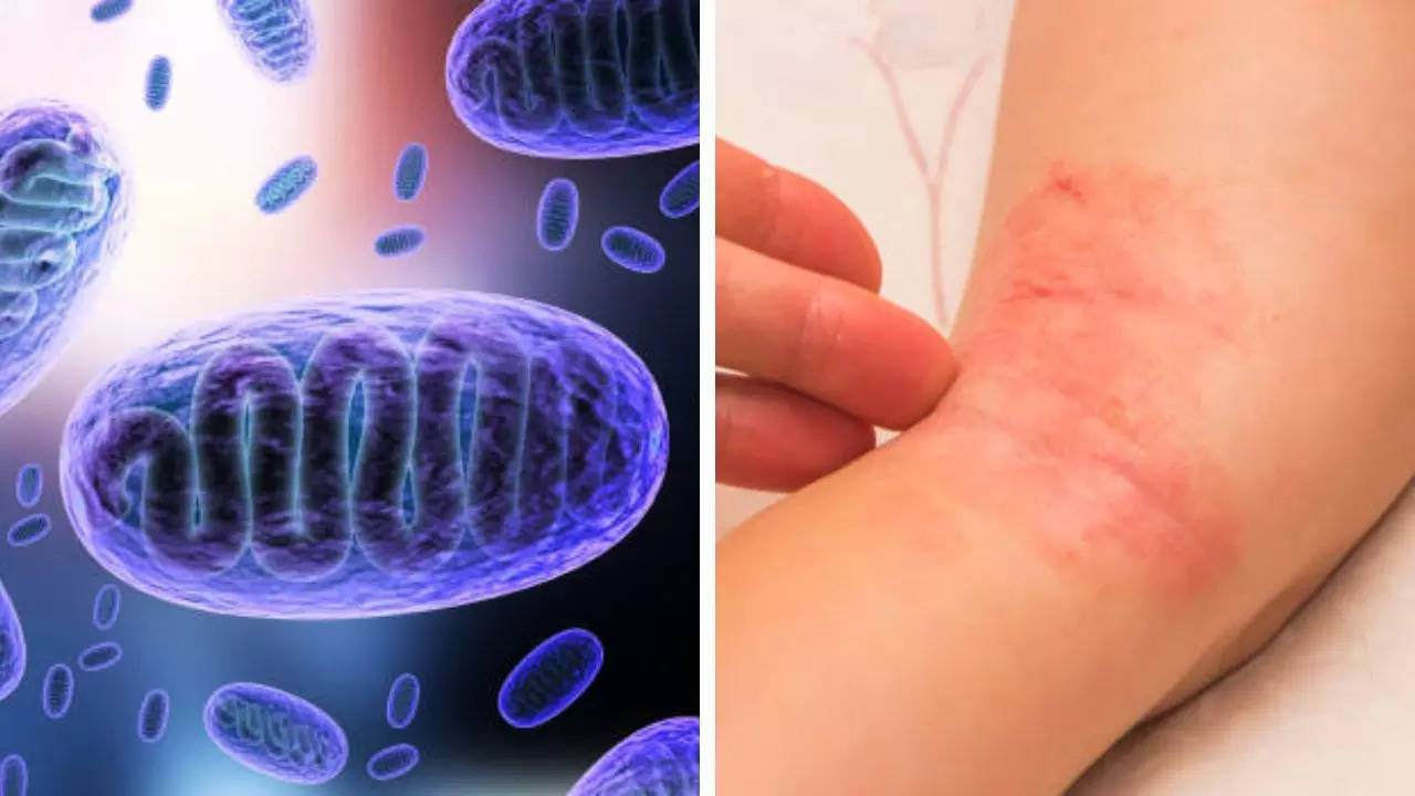 Scientists warn Deadly Fungal Infections Are Causing A Silent Epidemic