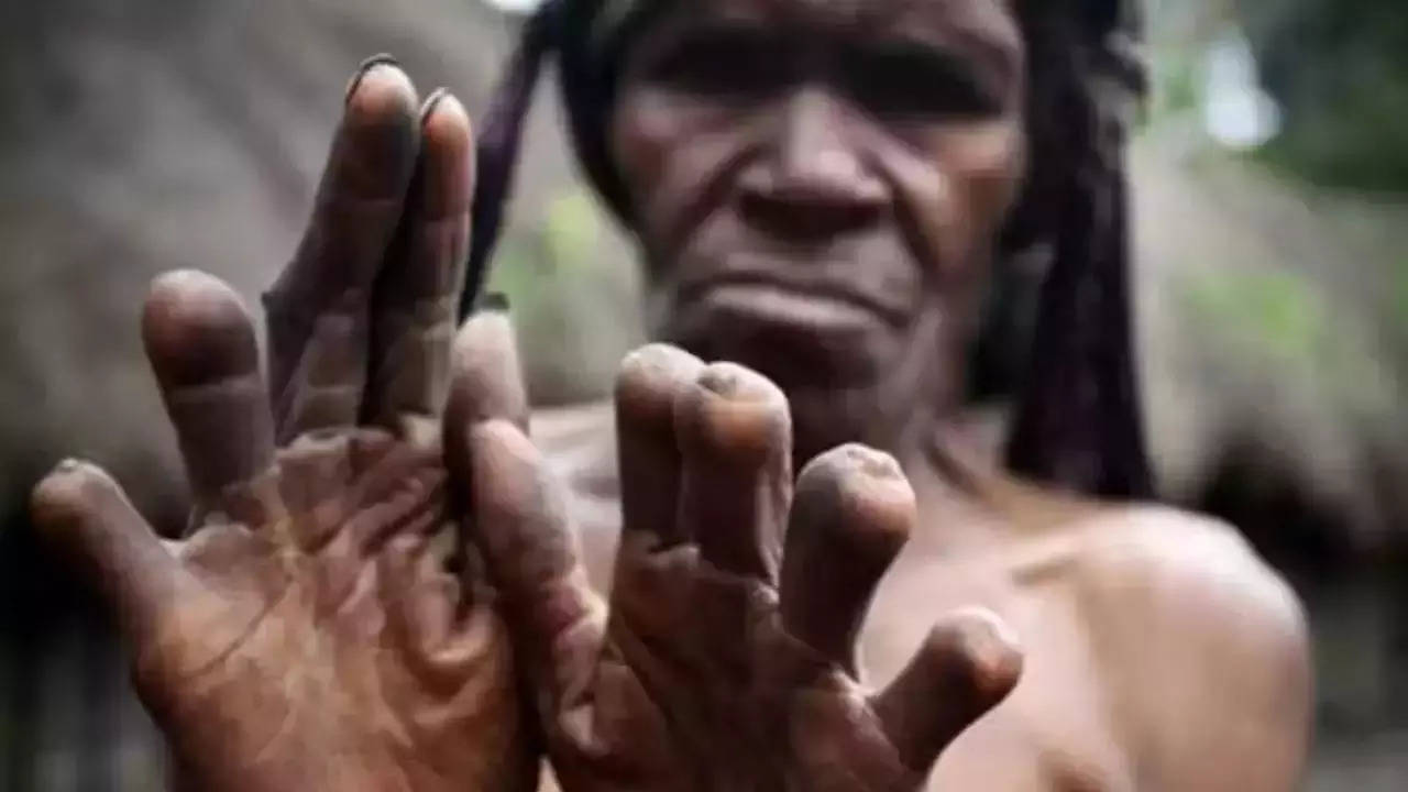 Bizarre News this tribal community cut women finger if anyone died in family