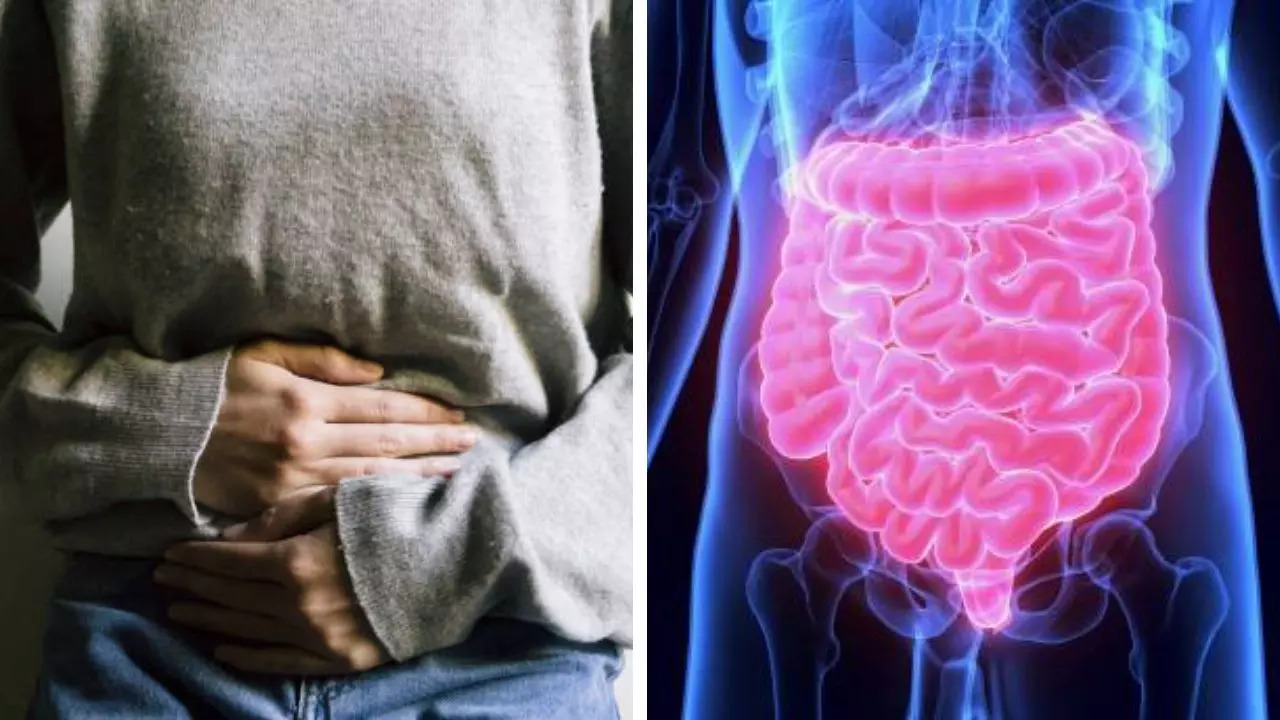 Signs that you suffer from a bad gut health