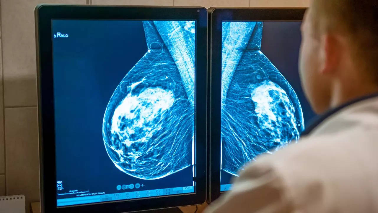 Tests Can Help In The Detection Of Breast Cancer​