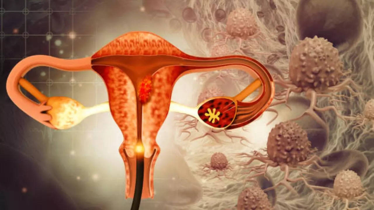 First-ever Ovarian Cancer Vaccine Could Wipe Out The Deadly Disease 