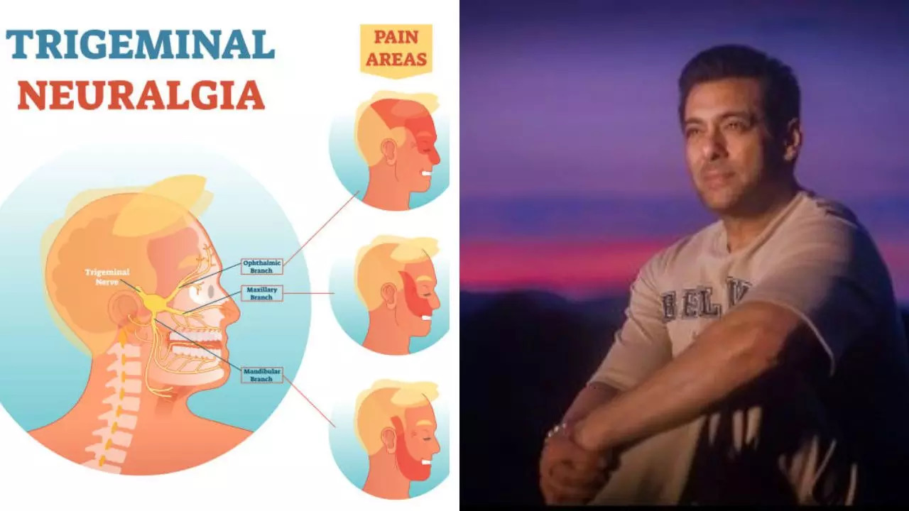 What Is Trigeminal Neuralgia, The Suicide Disease Which Salman Khan Was Once Diagnosed With