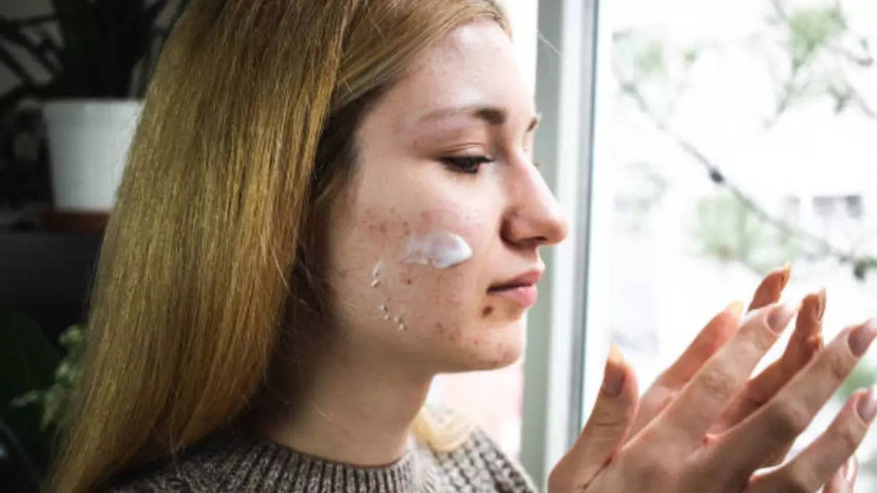 Common Acne Drug Can Become Carcinogenic at Room Temperature, Say Doctors