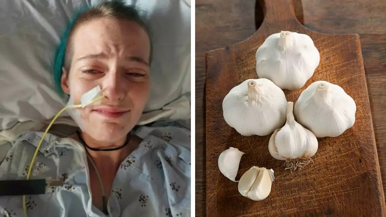 Minnesota Woman Suffers Agonizing Pain, Migraines After Eating Garlic