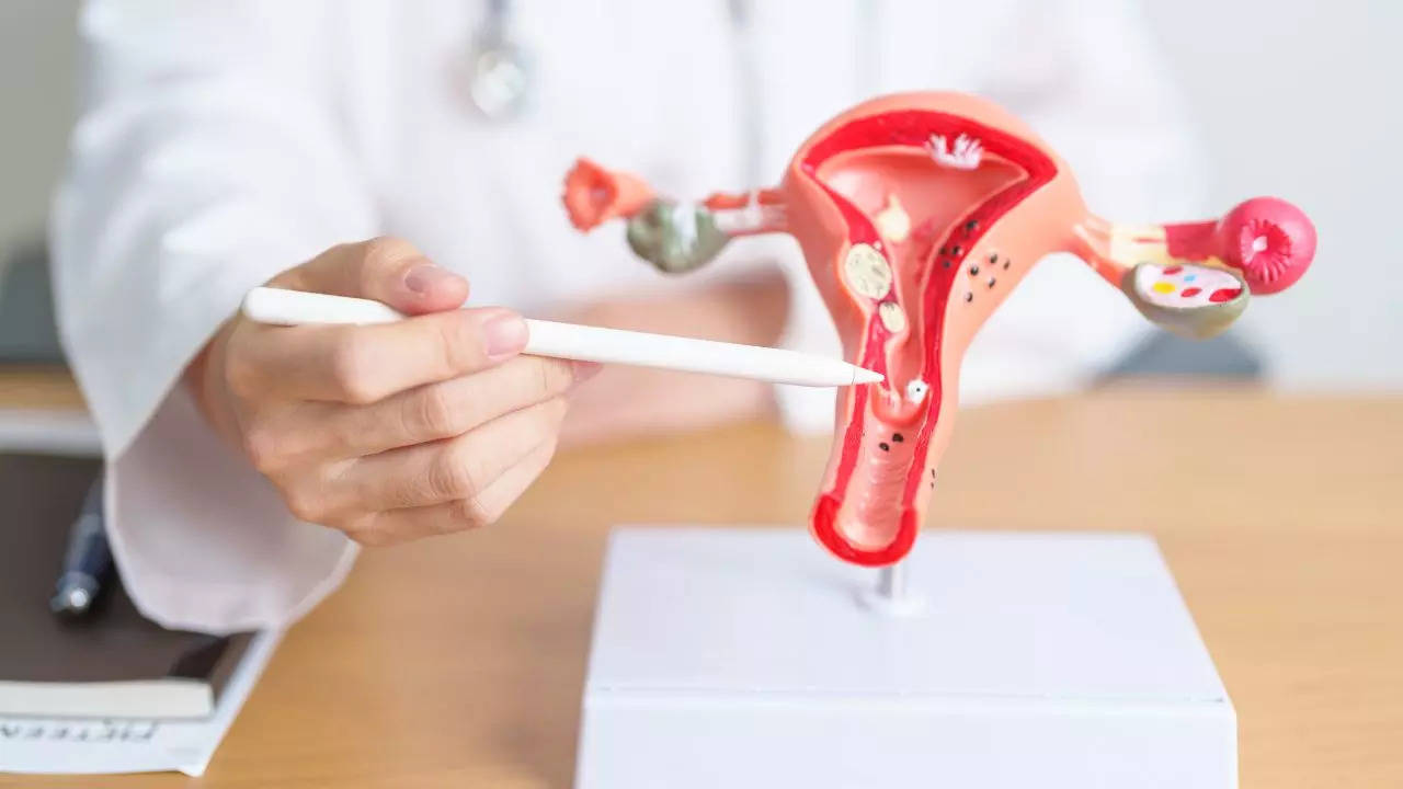 ​New Treatment For Cervical Cancer That Reduces Risk Of Death By 40 Per cent​