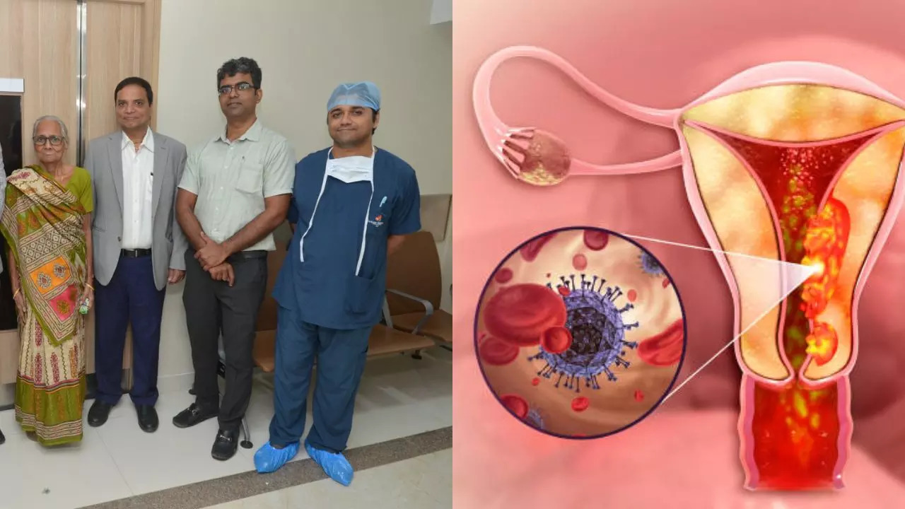 An 85 Year-Old Becomes Oldest Woman In India To Undergo Successful Ovarian Cancer Surgery