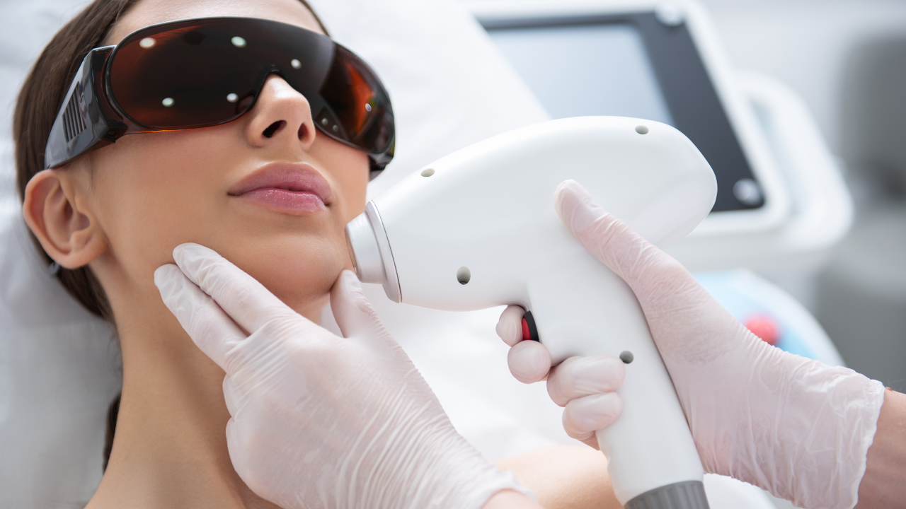 6 things to know before facial laser hair removal