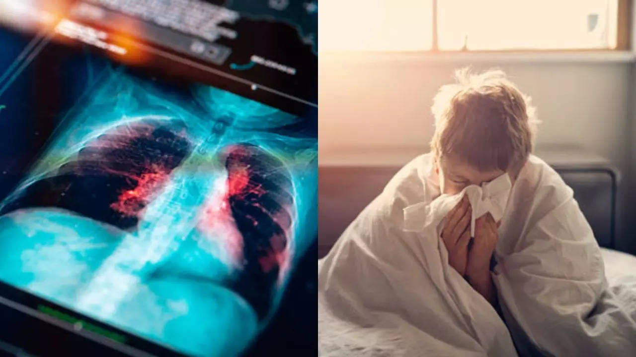 What Is Causing An Unusual Surge Of Walking Pneumonia Among Kids In The US This Year