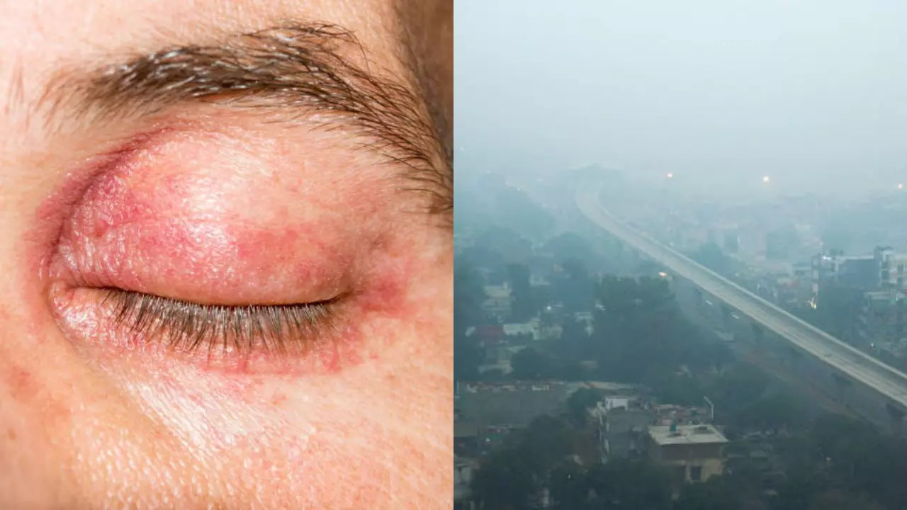 What Causes Eye Damage Know Expert-backed Tips To Keep Them Protected From Toxic Smog 