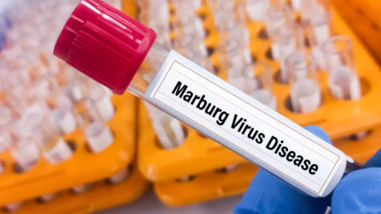 Rwanda Reports No Community Transmission Of Marburg Virus, Zero New Cases Recorded