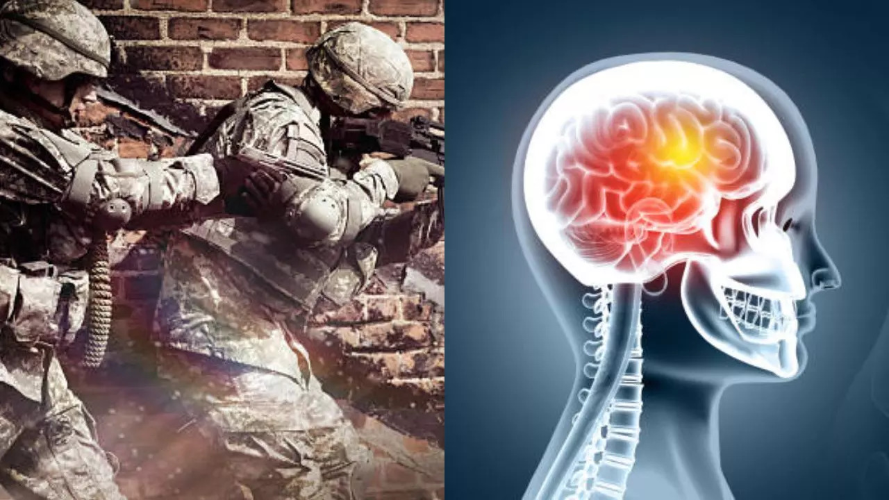 US Military Grapples With Growing Brain Injury Cases