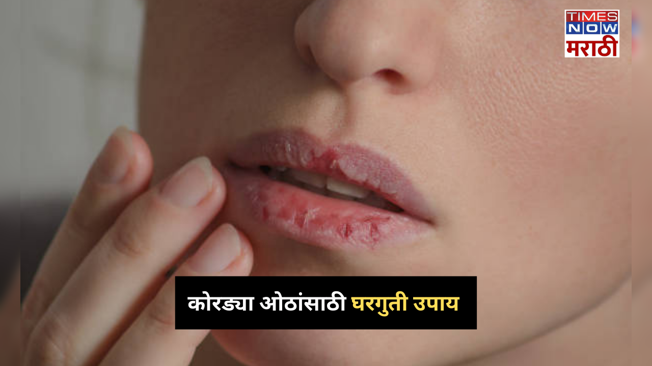 home remedies to avoid dry lips in cold