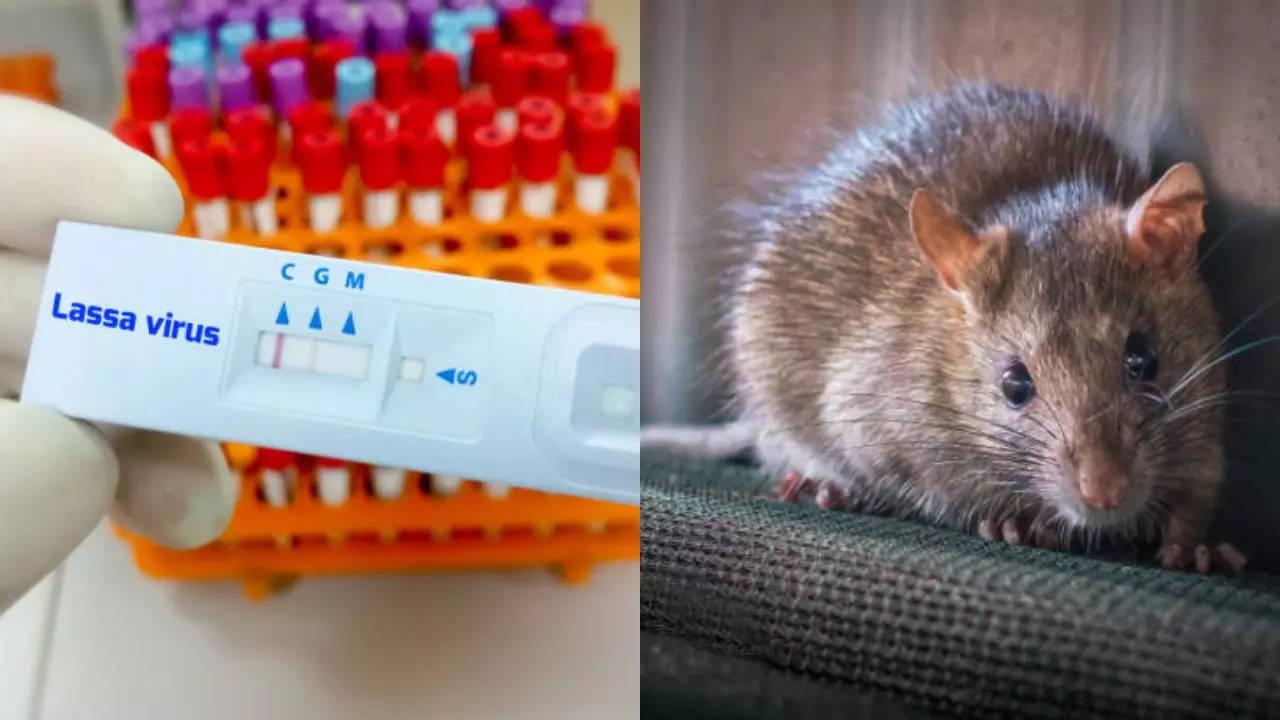 Iowa Resident Die In A Suspected case of Lassa fever, A Frightening, Rare Viral Disease 