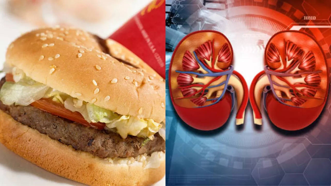 US Teen With Ecoli Now Battling Kidney Failure After Eating McDonald’s Quarter Pounders