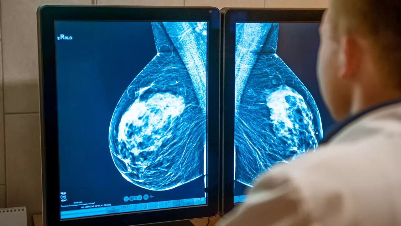 ​Lifestyle Changes To Prevent The Recurrence Of Breast Cancer