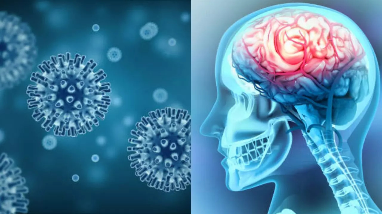 Common Infections That May Increase Risk of Dementia 