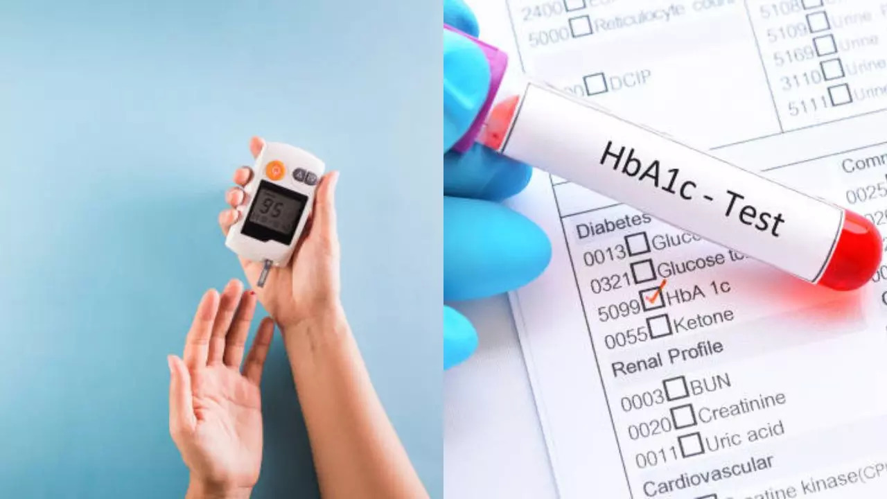 what all conditions lead to A1C Blood Sugar Tests For Type 2 Diabetes causing False Results