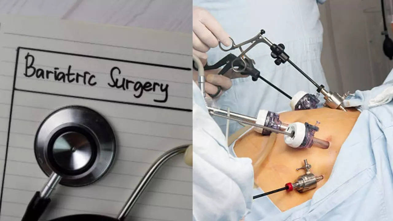 THIS Popular Weight Loss Surgery Is Said To Lower Cardiac Arrest Risk! Expert Explains How