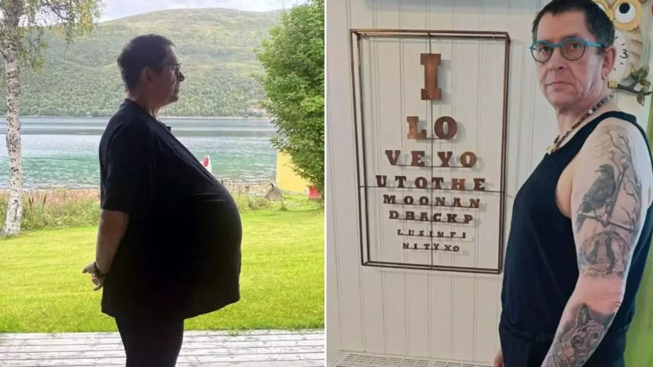 Man Dismissed as FAT For 12 Years, Given Ozempic For Weight Loss Doctors Had a 60-pound Malignant Tumour in His Belly 