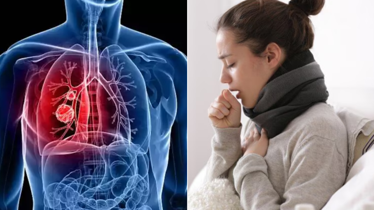 Pneumonia Home Remedies