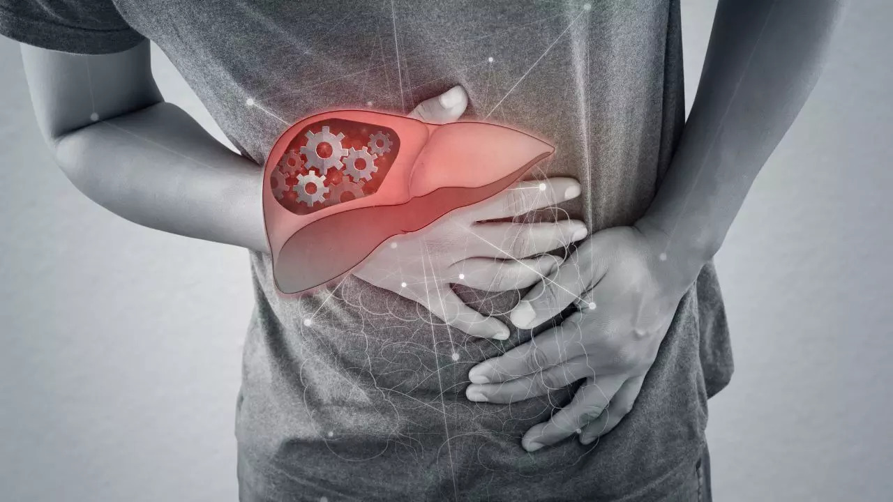 4 In 10 U.S. Adults Suffer From Fatty Liver Disease